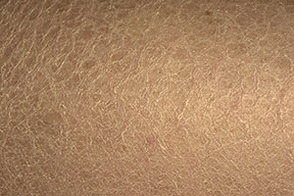 чешуеподобная поверхность кожи